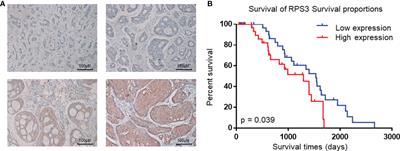 RPS3 Promotes the Metastasis and Cisplatin Resistance of Adenoid Cystic Carcinoma